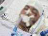 Nam sinh lớp 8 bị đánh chấn thương sọ não chuyển về Hà Nội điều trị