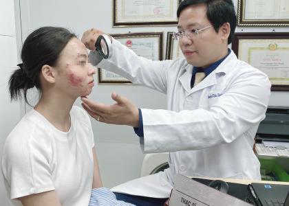 Uống thuốc tránh thai điều trị mụn, cô gái trẻ nhận kết đắng sau 3 tuần